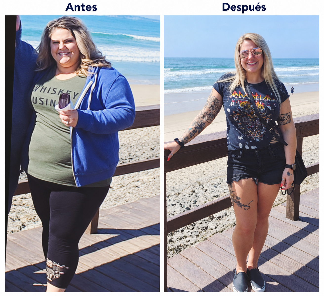 Manga gástrica · Antes y después