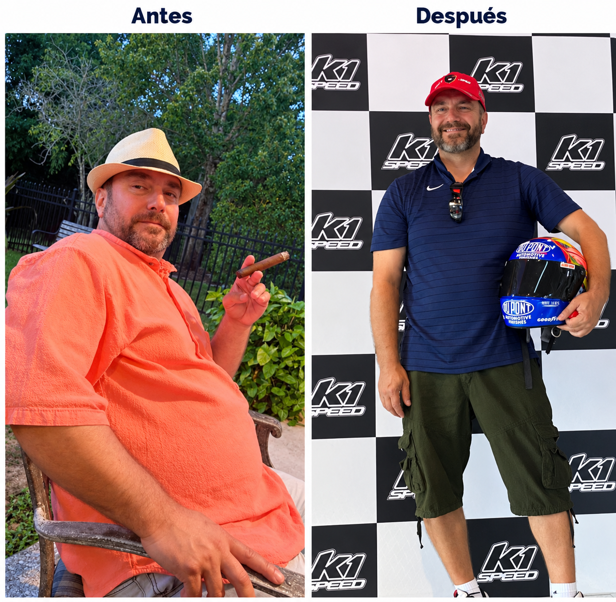 Manga gástrica · Antes y después