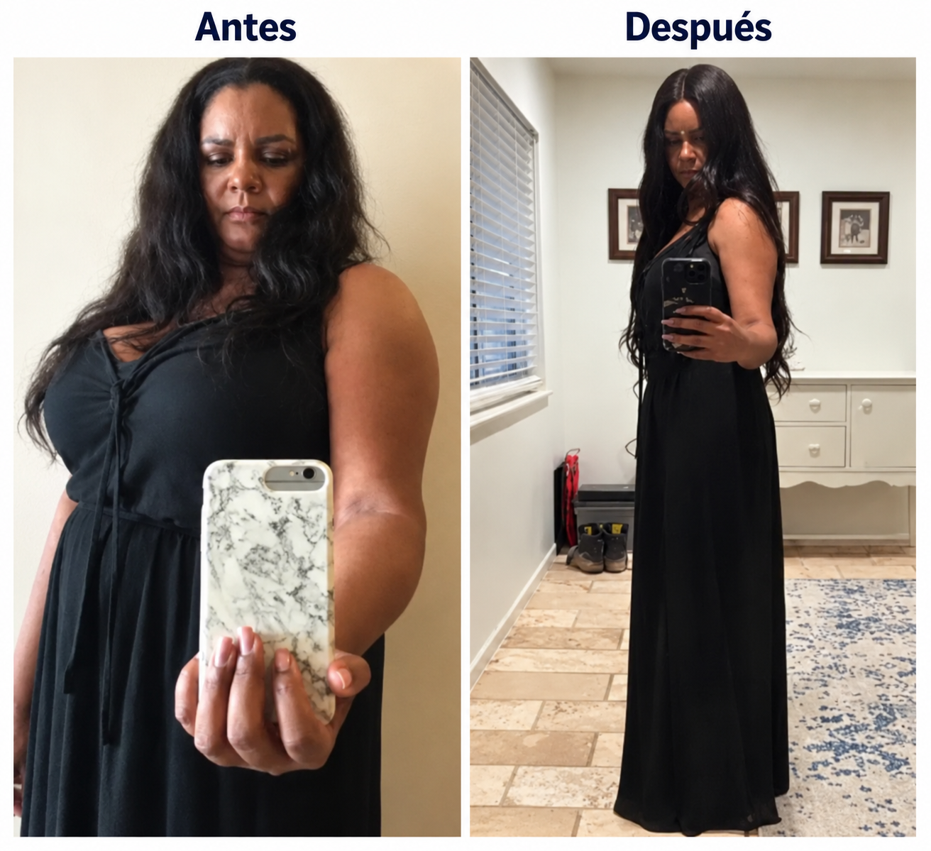 Manga gástrica · Antes y después
