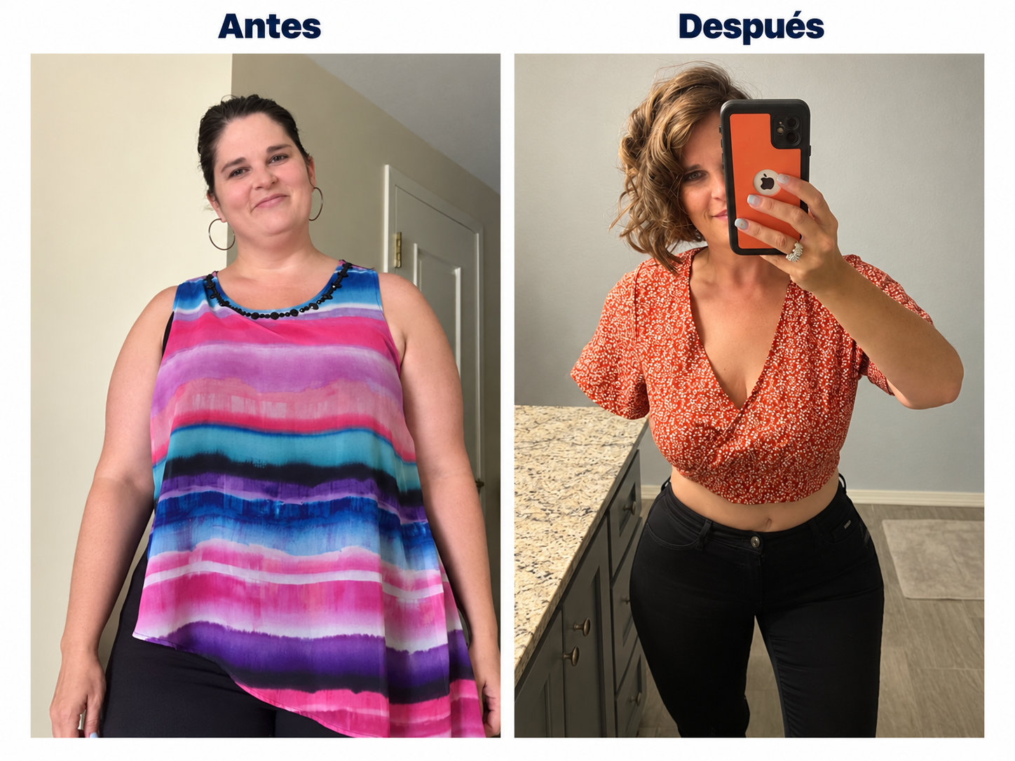 Manga gástrica · Antes y después