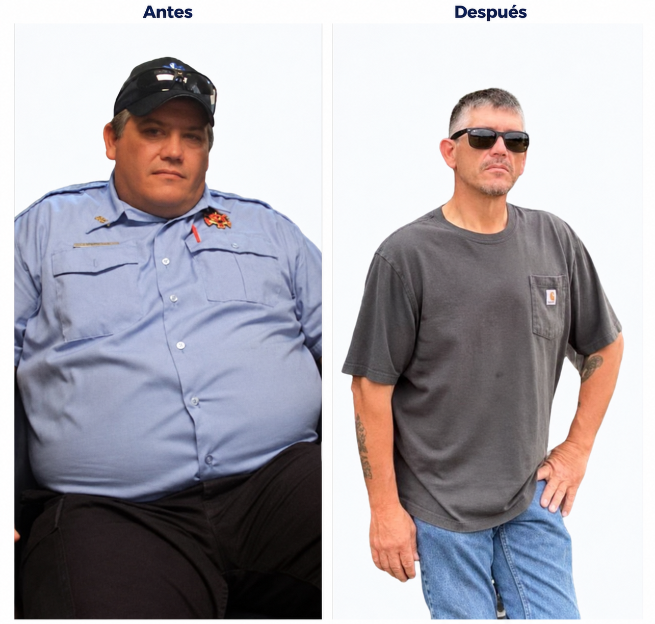Comparación de antes y después del paciente