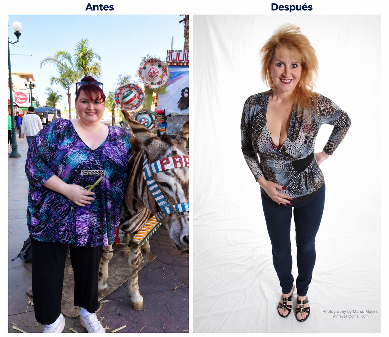 Comparación de antes y después del paciente