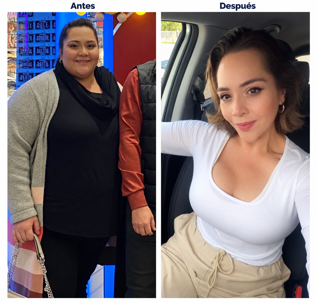 Comparación de antes y después del paciente